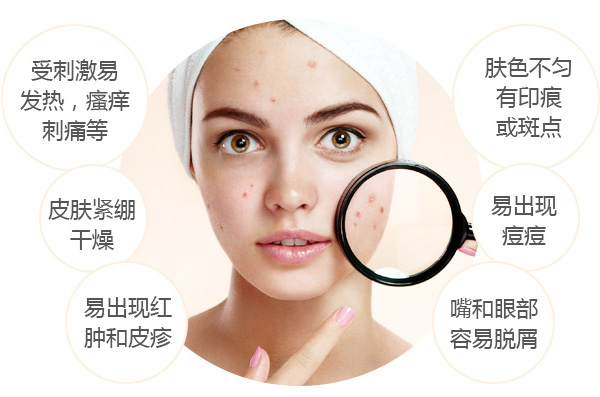 你的皮肤敏感吗